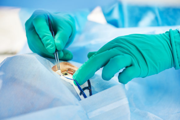 Retina Surgical Procedures
